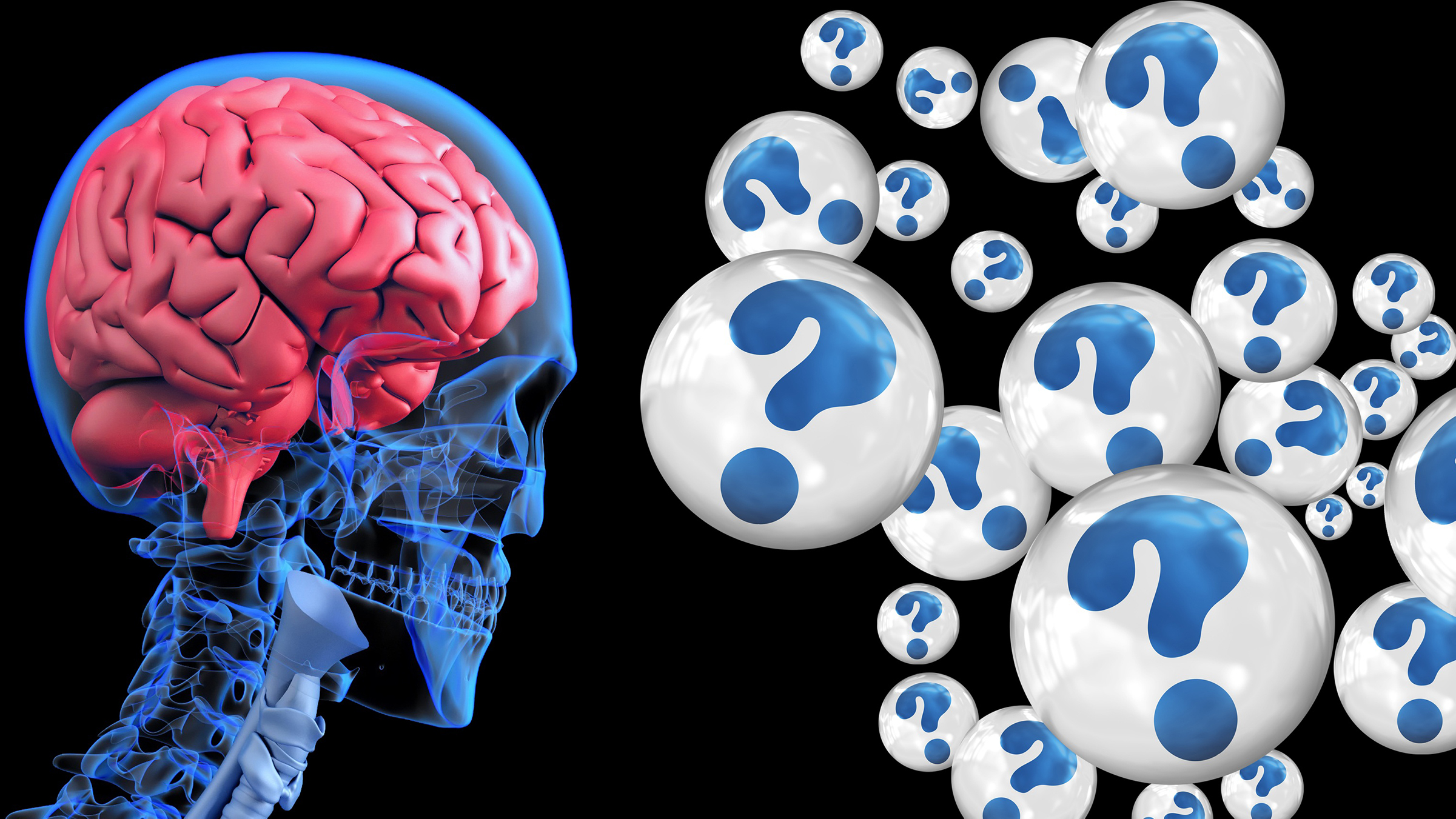 Graphic showing a human skull with a brain inside next to many circles with question marks inside Alzheimer's